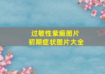 过敏性紫癜图片 初期症状图片大全